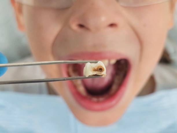 Best Same-Day Emergency Dental Services in Waverly, MI