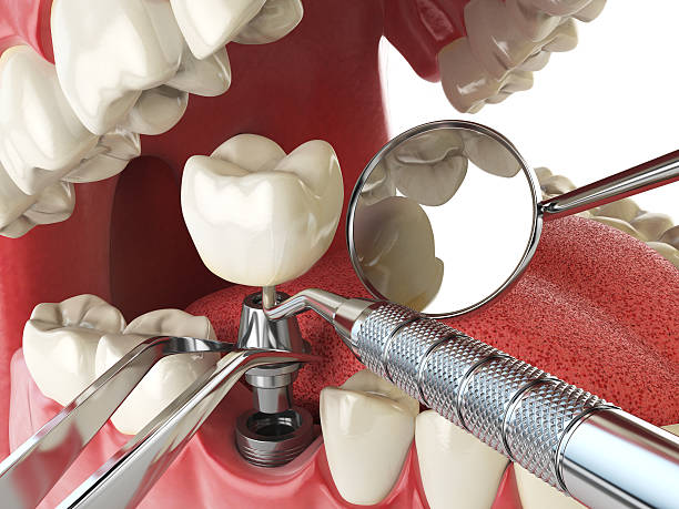 Best Cosmetic Emergency Dentistry in Waverly, MI